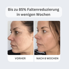 TV-Set 3 I Serum + Lifting Creme